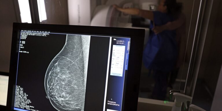 Entidades alertam médicos sobre pedidos de mamografia digital